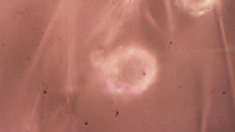 Un país de Latinoamérica descubre por primera vez microplásticos en cordones umbilicales de embarazadas