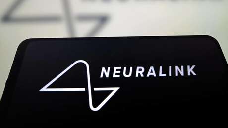 Mujer paralítica revela el impactante efecto del chip cerebral de Neuralink (VIDEO, FOTOS)