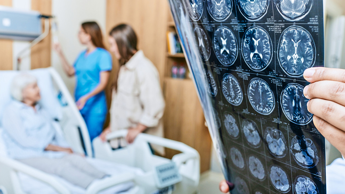 Descubren una combinación de compuestos naturales que limpian el cerebro de 'proteínas Alzheimer'