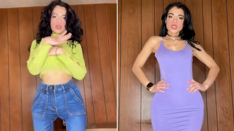 'Influencer' que nació con dos órganos reproductivos: "Crecí sintiéndome un monstruo"