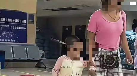 Salvan a una niña de 3 años con un cuchillo clavado en la cabeza