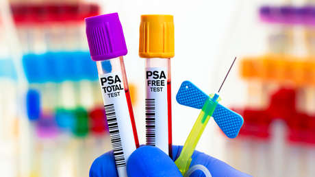 Un tratamiento frío puede ayudar con un tipo de cáncer que a menudo no presenta señales de advertencia