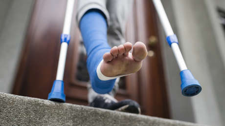 Obsesión por la altura: peligros de la polémica cirugía que alarga las piernas