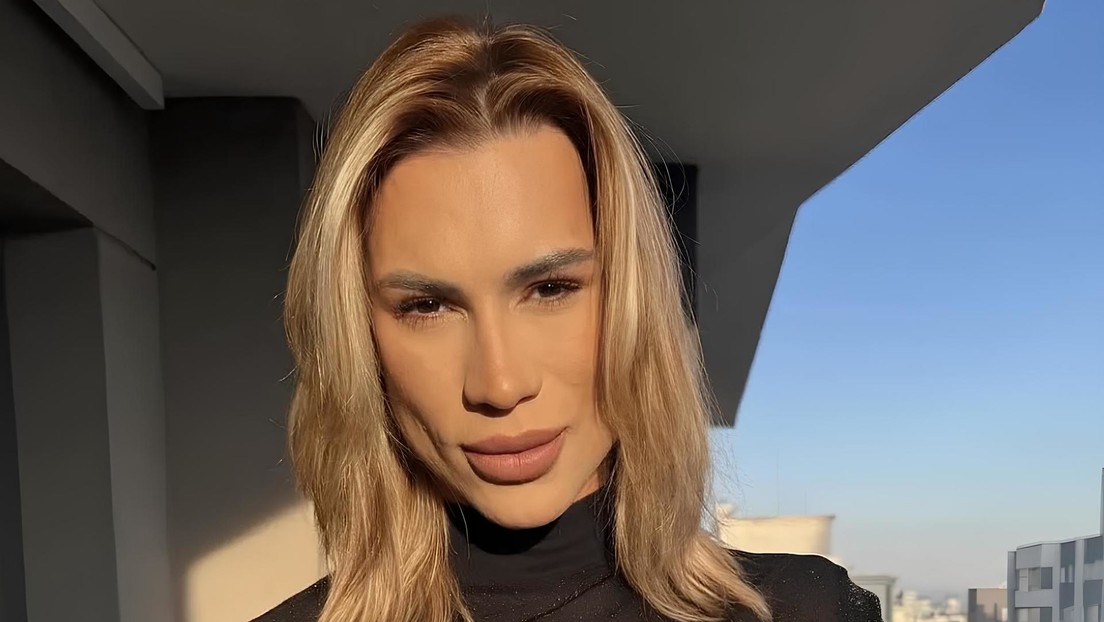 Fallece 'influencer' tras someterse a cirugía 'fox eyes'