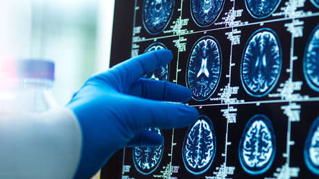 Gran avance en el tratamiento de una de las enfermedades más letales del mundo