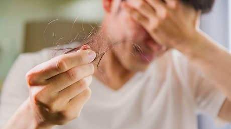 Los cinco países 'más calvos' de Latinoamérica