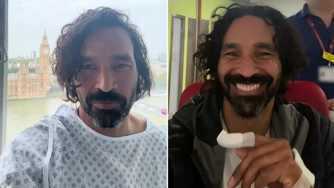 Un dedo 'licuado' y seis cirugías: el calvario de un hombre tras una mordedura de gato