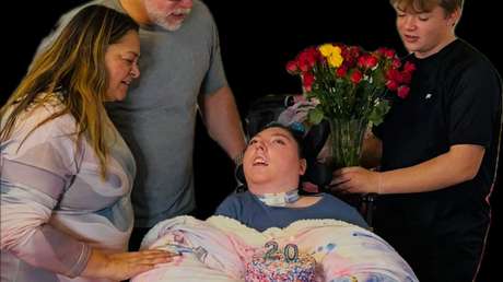 Milagro médico: joven nacida casi sin cerebro cumple 20 años