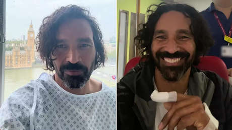 Un dedo 'licuado' y seis cirugías: el calvario de un hombre tras una mordedura de gato