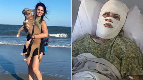 Una mujer queda desfigurada tras un ataque aleatorio con un químico corrosivo (FOTOS FUERTES)