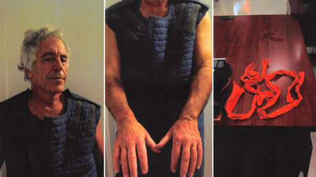 FUERTES IMÁGENES: Fotos inéditas de Epstein tras posible intento de suicidio