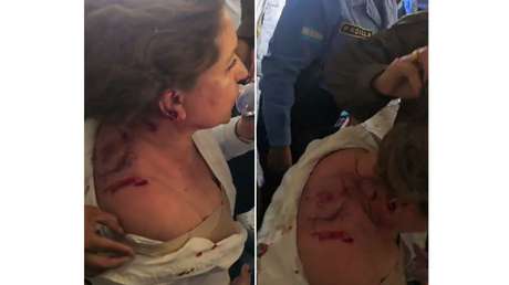 VIDEO: Consecuencias de la explosión de un artefacto lanzado a una diputada hondureña