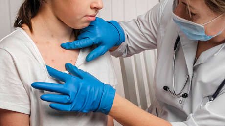 EE.UU. sufre el peor brote de la enfermedad más contagiosa del mundo en décadas