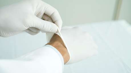 Se explotó un grano en la cara y tuvo que ser hospitalizada