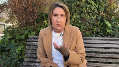 Realizan el primer trasplante de cara del mundo a partir de una donante fallecida por eutanasia