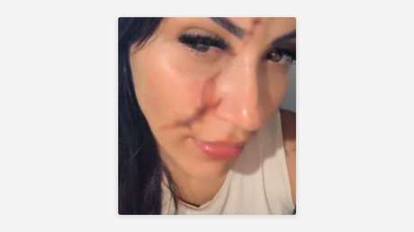 Le raja la cara con un vidrio a una mujer y se burla de ella en redes sociales