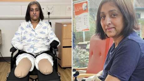 Una mujer pierde sus cuatro extremidades tras ser lamida por un perro