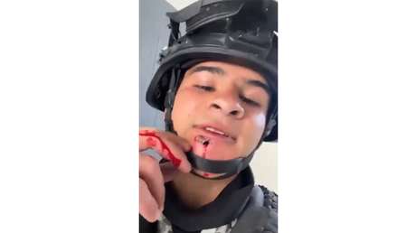 FUERTE VIDEO: Soldado mexicano sobrevive y se ríe tras recibir un disparo en la cara