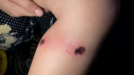 Informan que el Ejército israelí torturó a un niño palestino de 18 meses y las FDI responden