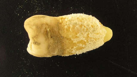 Diente de una momia boliviana cambia lo que se creía de una contagiosa enfermedad