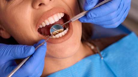 Este alimento cotidiano podría estar dañando tus dientes